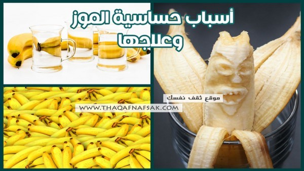 ما هي أسباب حساسية الموز و كيف أعالجها ؟