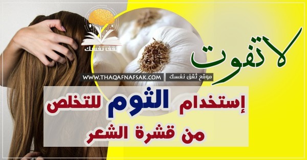 علاج قشرة الشعر بالثوم ٥ طرق ستزيل القشرة نهائي علاج قشرة الشعر بالثوم ٥ طرق ستزيل القشرة نهائي