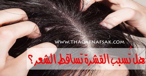 هل تسبب القشرة تساقط الشعر والصلع ؟ هل تسبب القشرة تساقط الشعر والصلع ؟