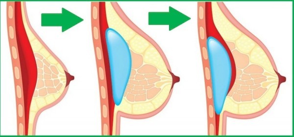 فيتامينات تكبير الثدى تناولي هذه الأنواع الخمسة و ستلاحظين الفرق