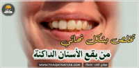 كيفية التخلص من البقع البنية على الاسنان كيفية التخلص من البقع البنية على الاسنان