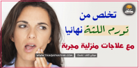 علاج تورم اللثة بـ ٨ وصفات منزلية سهلة ومُجربة
