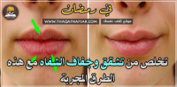 منع جفاف وتشقق الشفاه في رمضان ٩ طرق سريعة منع جفاف وتشقق الشفاه في رمضان ٩ طرق سريعة