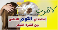 علاج قشرة الشعر بالثوم ٥ طرق ستزيل القشرة نهائي علاج قشرة الشعر بالثوم ٥ طرق ستزيل القشرة نهائي