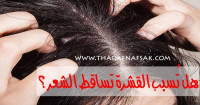 هل تسبب القشرة تساقط الشعر والصلع ؟ هل تسبب القشرة تساقط الشعر والصلع ؟