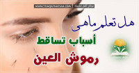 تساقط الرموش ٩ أسباب شائعة تؤدي لفقدانها