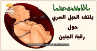 ماذا يحدث عندما يلتف الحبل السري حول رقبة الجنين