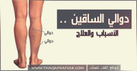 كيف تعالج دوالي الساقين .. الأسباب والعلاج كيف تعالج دوالي الساقين .. الأسباب والعلاج