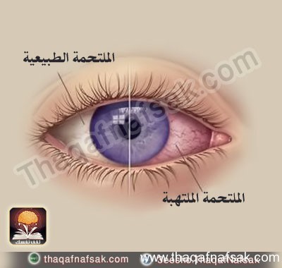 بالصور أسرار لا تعرفها كيف يتم فحص العين ؟ وكيف تفحص عينك بنفسك