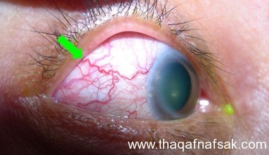 بالصور أسرار لا تعرفها كيف يتم فحص العين ؟ وكيف تفحص عينك بنفسك