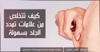 كيف اتخلص من الخطوط البيضاء في الجسم كيف اتخلص من الخطوط البيضاء في الجسم
