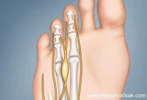 بالصور : اعرف صحتك من قدمك