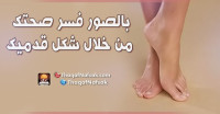 بالصور : اعرف صحتك من قدمك