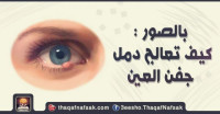 بالصور طريقة علاج دمل العين بطرق منزليه