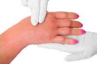 كيف تتخلص من احتباس السوائل في الجسم ؟ الأسباب والعلاج بين يديك