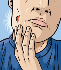 نصائح لعلاج حب الشباب و وصفات طبيعية للتخلص منه ستفيدك جدا نصائح لعلاج حب الشباب و وصفات طبيعية للتخلص منه ستفيدك جدا