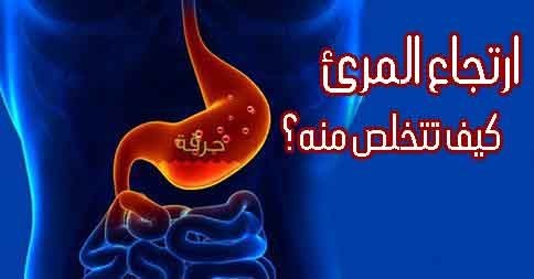 أهم ما يجب معرفته عن ارتجاع المرئ اسبابه وعلاجه لتتخلص منه أهم ما يجب معرفته عن ارتجاع المرئ اسبابه وعلاجه لتتخلص منه
