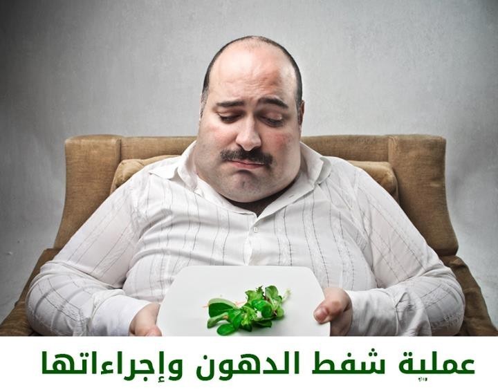 معلومات عن عملية شفط الدهون