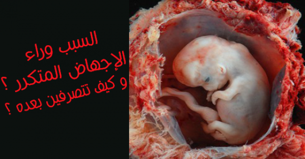 أحذرن أسباب الإجهاض المتكرر و كيف تتصرفن بعده ؟ أحذرن أسباب الإجهاض المتكرر و كيف تتصرفن بعده ؟