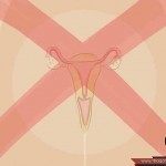 أحذرن أسباب الإجهاض المتكرر و كيف تتصرفن بعده ؟ أحذرن أسباب الإجهاض المتكرر و كيف تتصرفن بعده ؟