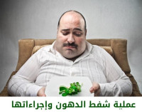 معلومات عن عملية شفط الدهون