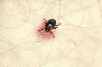 أسعاف وعلاج لدغ الحشرات بتسعة خلطات منزلية مجربة