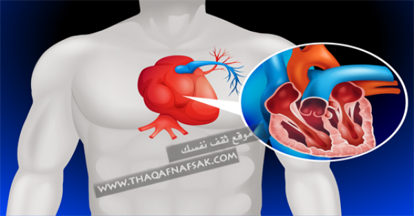 علاج انسداد الشرايين بمجموعة نصائح وطرق منزلية علاج انسداد الشرايين بمجموعة نصائح وطرق منزلية