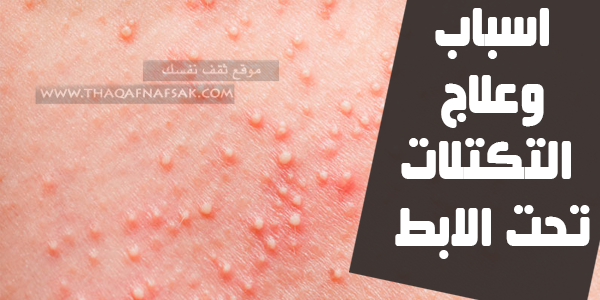 تظهر لديك تكتلات تحت الأبط ما السبب وما العلاج؟ تظهر لديك تكتلات تحت الأبط ما السبب وما العلاج؟