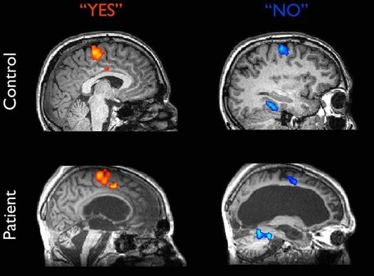 أفضل تطبيقات الهواتف الذكية لزيادة قدراتك العقلية