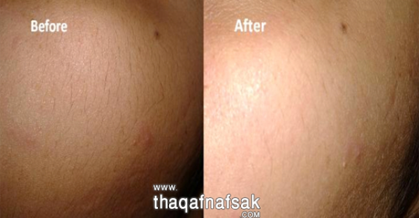 تشقير شعر الوجه بالطماطم والدقيق تشقير شعر الوجه بالطماطم والدقيق