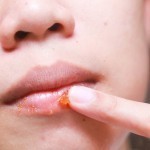 تقشير الشفاه بمقشر من صنع يديك