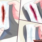 كيفية التعامل مع إفرازات بعد الولادة بالصور