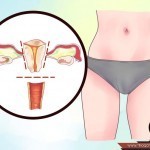 كيفية التعامل مع إفرازات بعد الولادة بالصور