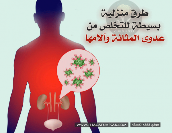 طرق منزلية لعلاج عدوى المثانة وآلامها طرق منزلية لعلاج عدوى المثانة وآلامها