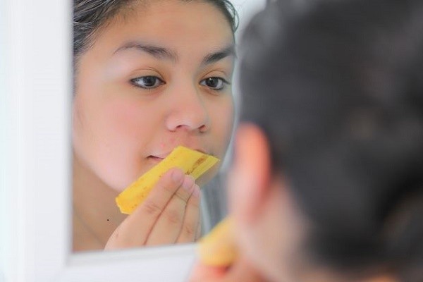 لا يفوتك فوائد قشر الموز للعناية بجمالك