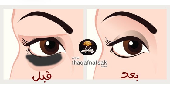 زيت الخروع لعلاج الهالات السوداء وتجاعيد العين زيت الخروع لعلاج الهالات السوداء وتجاعيد العين