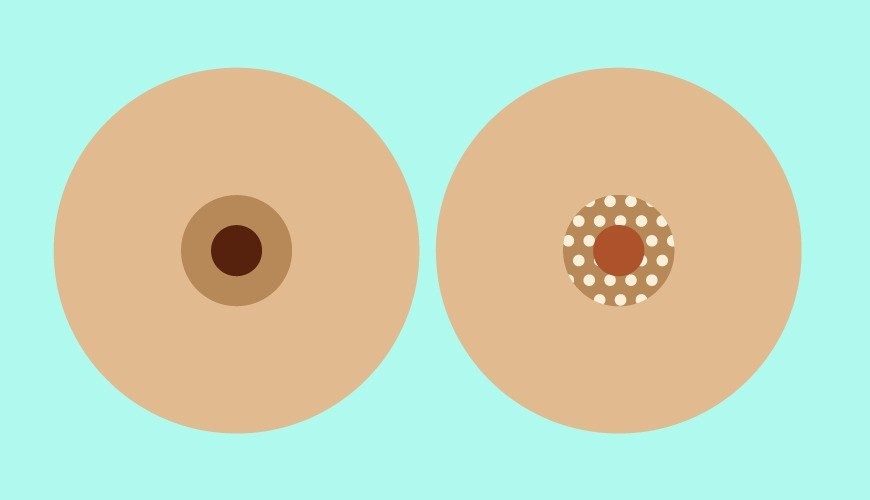 أسباب وعلاج تشقق الحلمة أسباب وعلاج تشقق الحلمة