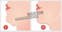 تمارين للتخلص من دهون الذقن المزدوج