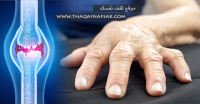 وصفات هامة في علاج إلتهاب مفاصل اليدين وصفات هامة في علاج إلتهاب مفاصل اليدين