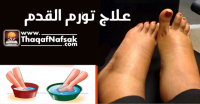 علاج أنتفاخ وتورم القدم أبرز الطرق الجديدة