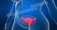 تعرفي على ألم المبيضين أسبابه وطرق علاجه