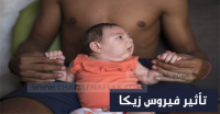 دليلك الشامل للتعرف علي فيروس زيكا