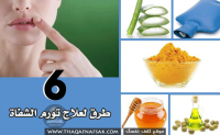 علاج تورم الشفاه بسرعة وطبيعيا علاج تورم الشفاه بسرعة وطبيعيا