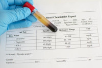 كيفية قراءة تحليل الكوليسترول في الدم ؟ كيفية قراءة تحليل الكوليسترول في الدم ؟