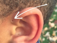 لماذا يمتلك بعض الناس جيب أمام الأذن ؟ لماذا يمتلك بعض الناس جيب أمام الأذن ؟