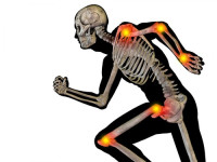 مجموعة علاجات طبيعية لالتهاب المفاصل سهلة و ذات مفعول قوي