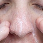 طريقة عمل ماسك لاصق لإزالة الروؤس السوداء