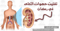 تفتيت حصوات الكلي في رمضان و تخفيف أوجاعها ١٧ طريقة