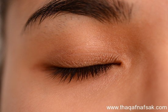 كيف تعالج جفاف العين ؟ كيف تعالج جفاف العين ؟