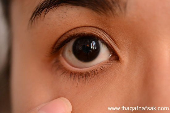 كيف تعالج جفاف العين ؟ كيف تعالج جفاف العين ؟